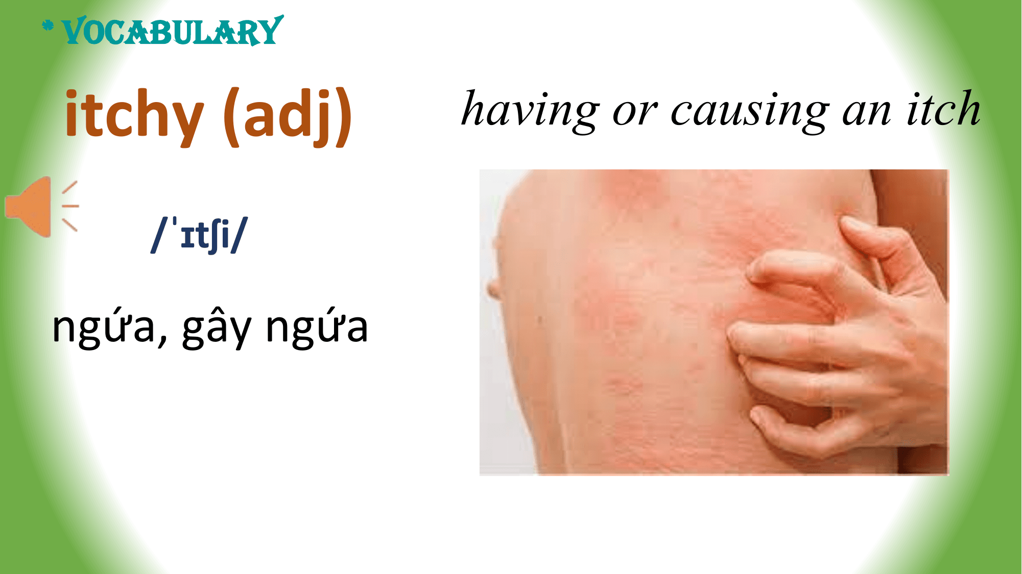 * VOCABULARY

 itchy (adj) having or causing an itch

 /ˈɪtʃi/

ngứa, gây ngứa